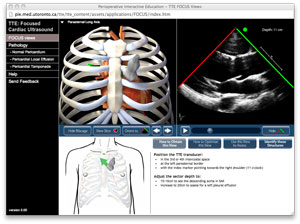 screen capture of FOCUS module